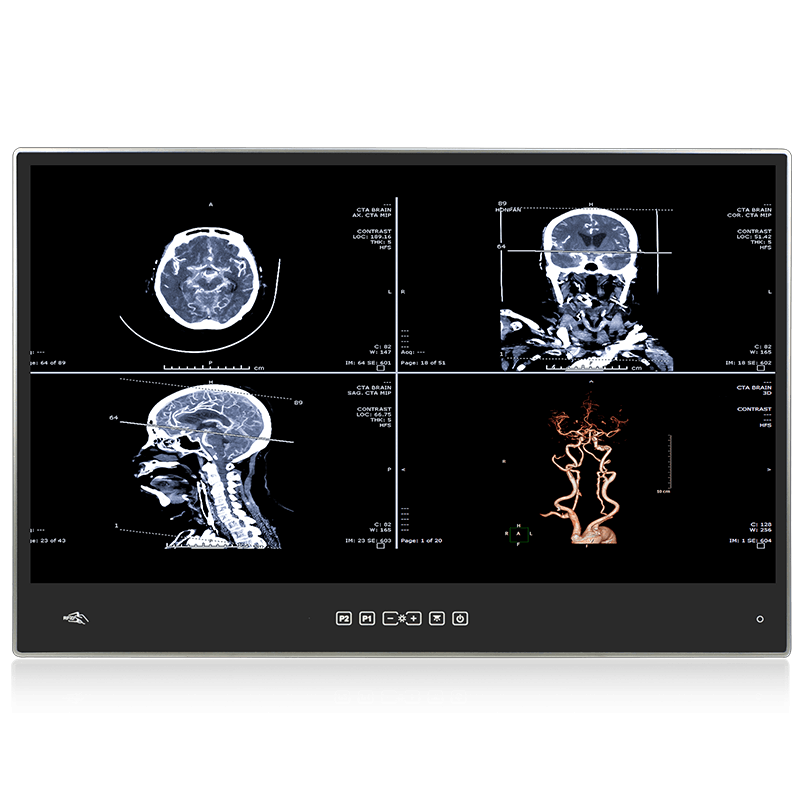 IEI POCi-W22C-ULT5 Medical Panel PC-1