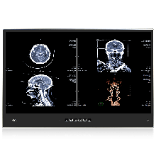 IEI POCi-W22C-ULT5 Medical Panel PC-1