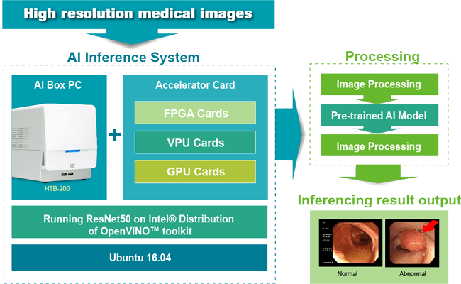 AI Inference in Colonoscopy