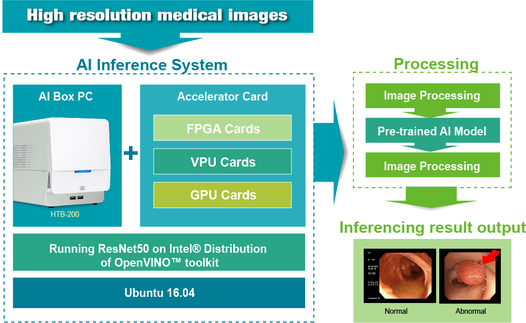 AI Inference in Colonoscopy